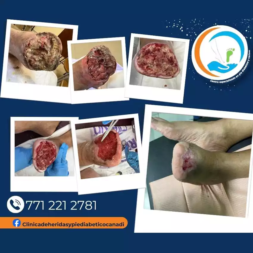 Grupo Medico Quirúrgico CANADI