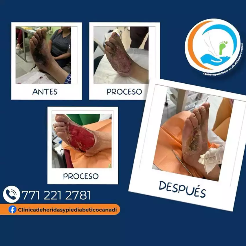 Grupo Medico Quirúrgico CANADI