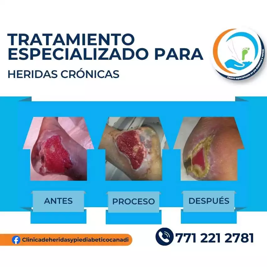 Grupo Medico Quirúrgico CANADI